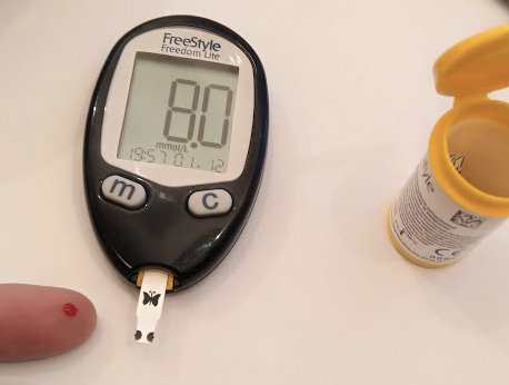 Blood Glucose Monitoring